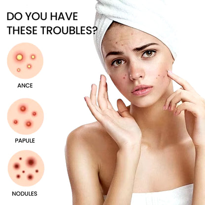 Repair Acne Patch Facial Skin Care Fade Blemishes Pimple Marks Closed Acne Blemishes Cover Acne Pimple Repair Patch